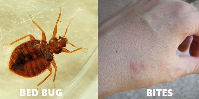 Dust Mite Bites vs Bed Bug Bites Pictures