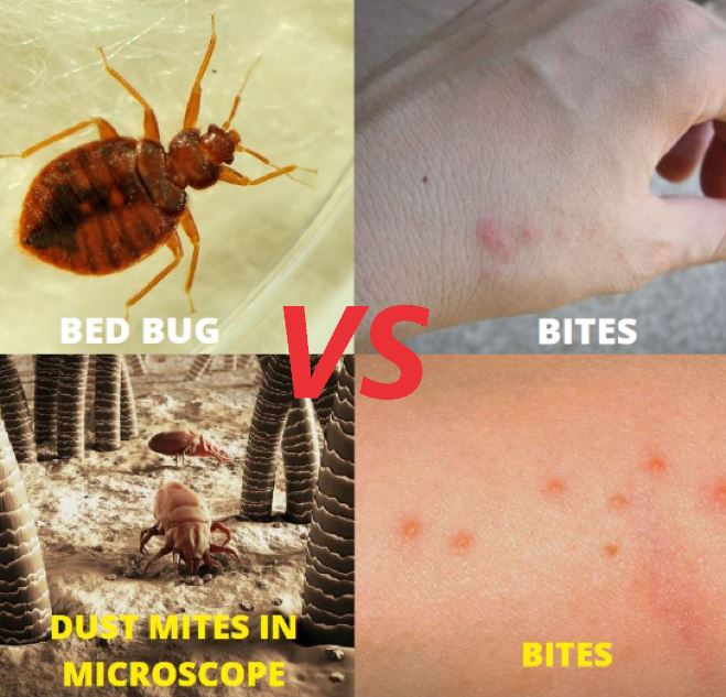 Bed Bug Bites vs Dust Mites in 7 Points Explained!
