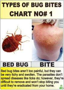 12 Most Harmful Types Of Bug Bites Chart Explained! | Y-L-P-C