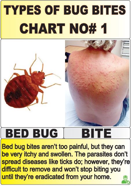 type of bug bites chart no 1