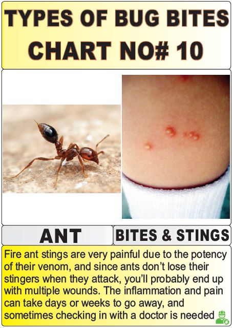 types of bug bites chart