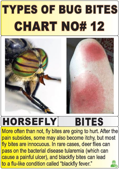 types of bug bites chart