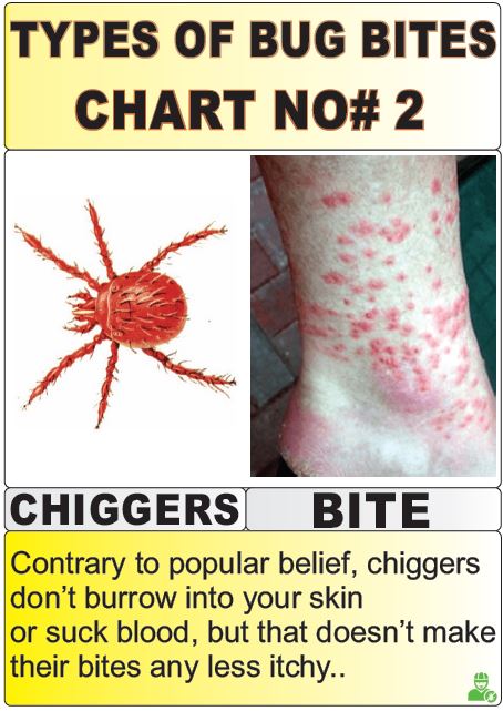 types of bug bites chart