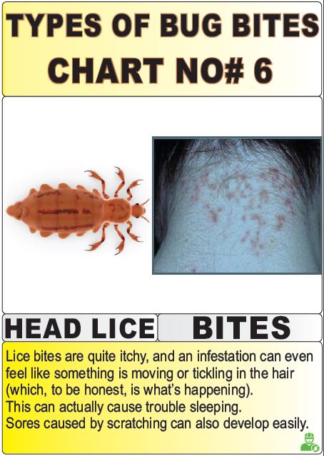 types of bug bites chart