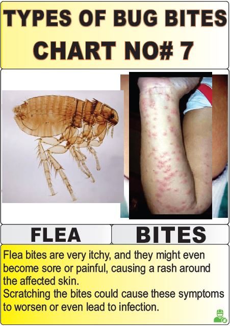 types of bug bites chart