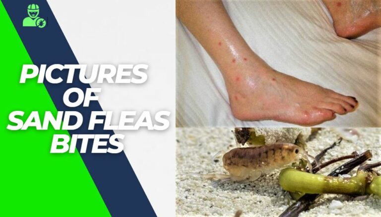 Top 7 Pictures of Sand Flea Bites!