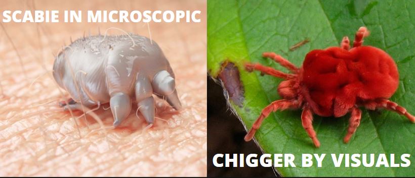 Chiggers vs Scabies Pictures